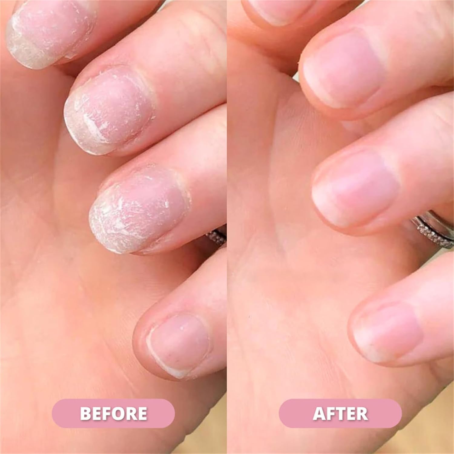 Nail Growth & Cuticle Oil Pen – Radiant Serum Nutrient Pen for Moisturizing, Strengthening & Brightening Nails - Image 3