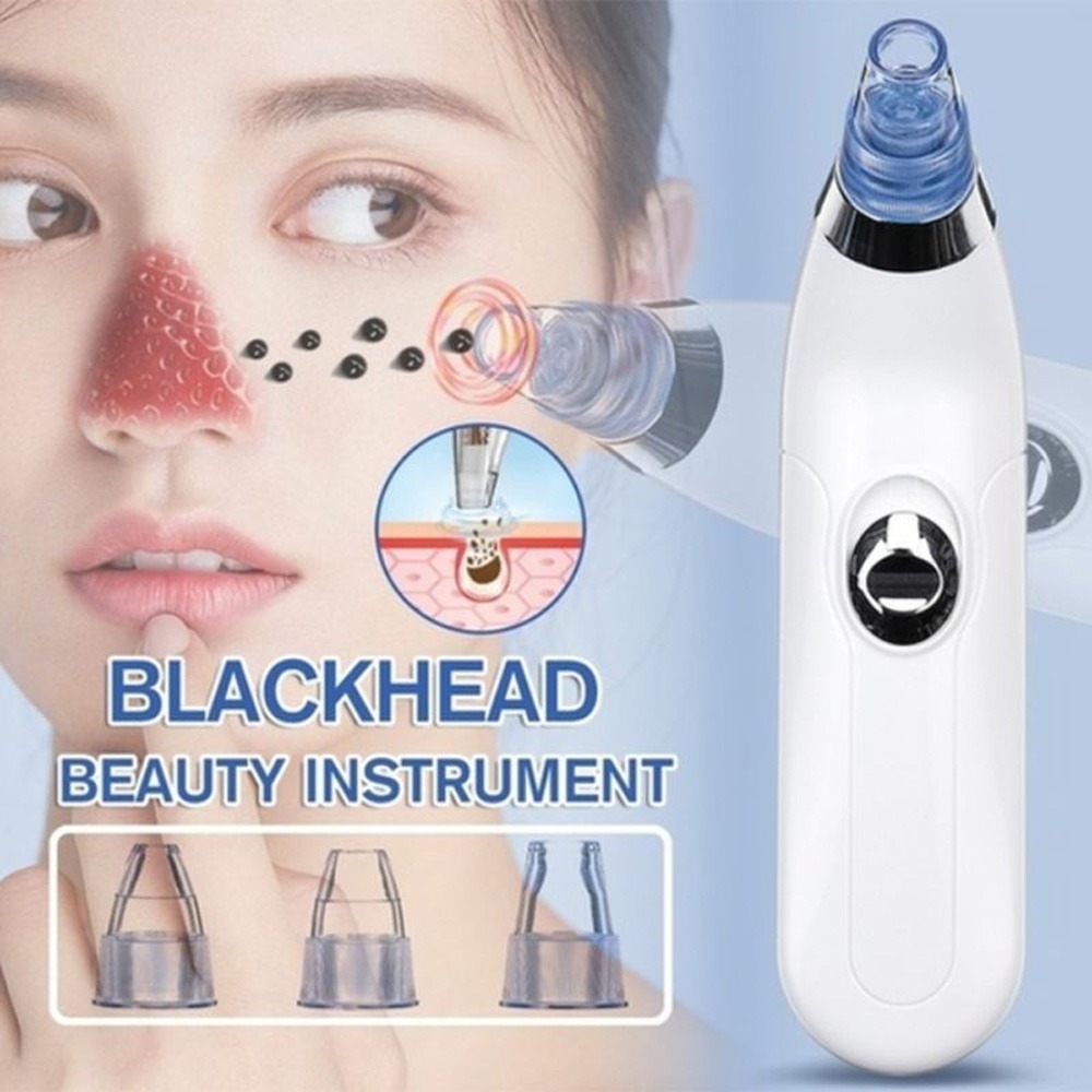 And Blackheads