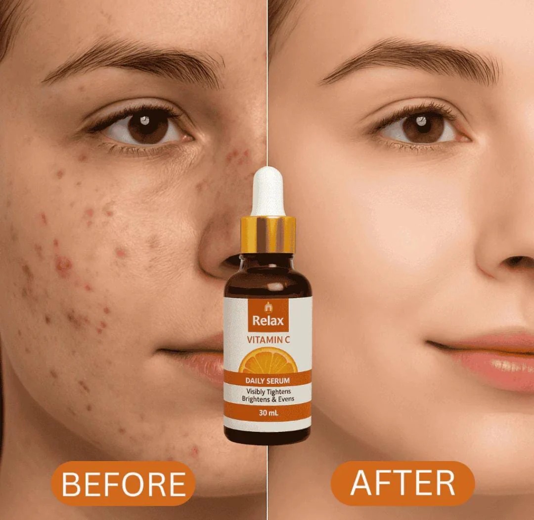 Relax Vitamin C Daily Serum – Brightening & Anti-Aging Face Serum - 30ml