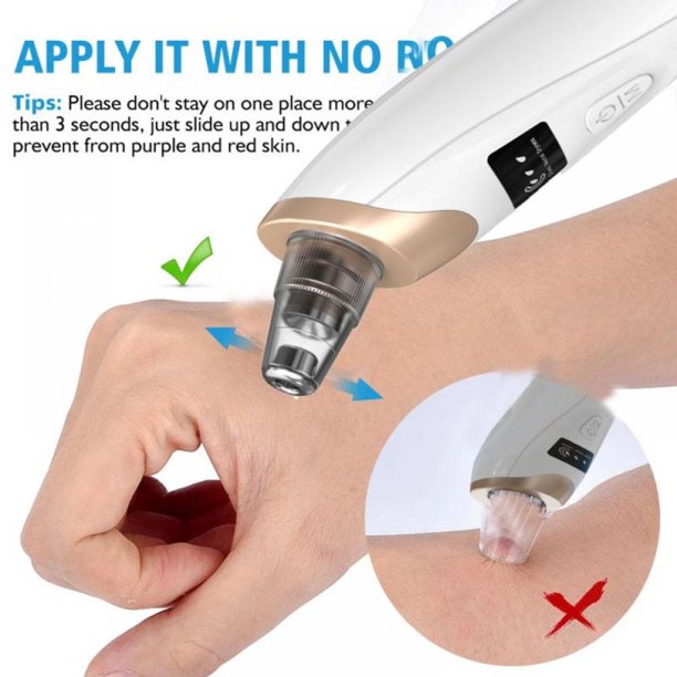 Electric Suction Blackhead Instrument Home Beauty Instrument Blackhead Pore Cleaning. - Image 5