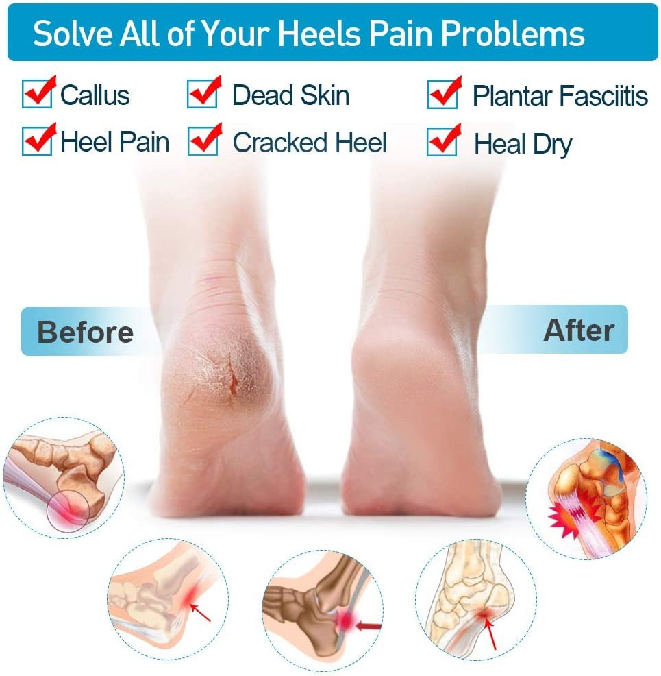 Silicone Heel Protector Sleeve for Cracked Heels & Pain Relief – Breathable & Cushioned Support - Image 4