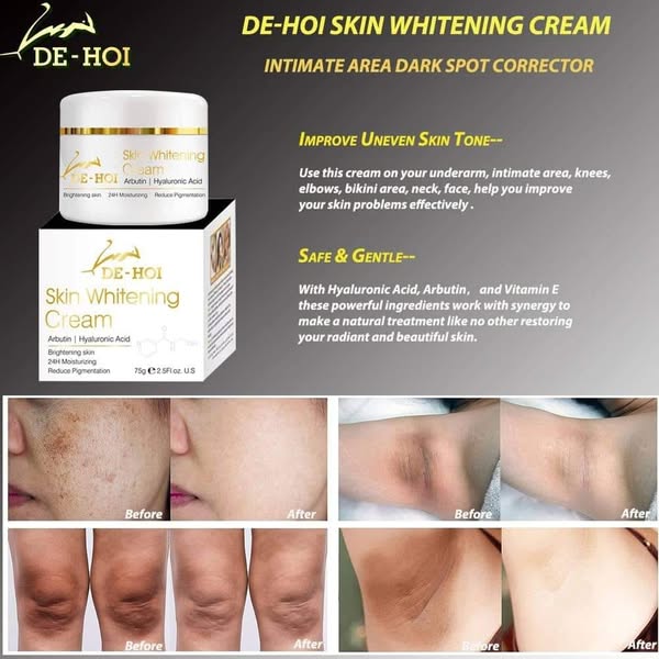 DE HOI Skin Whitening Cream – Brightening & Moisturizing Face and Body Cream for Dark Skin - 75 gram - Image 4