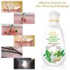 De-Hoi Refresh Anti-hair Loss Shampoo Ginger Hair Care Shampoo Helps Stop Hair Loss 450ml - Image 5