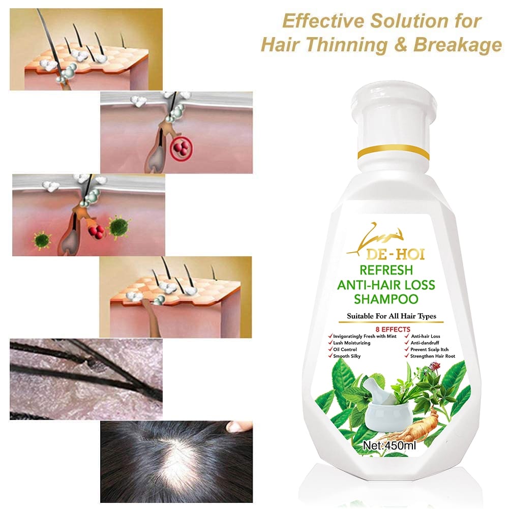De-Hoi Refresh Anti-hair Loss Shampoo Ginger Hair Care Shampoo Helps Stop Hair Loss 450ml - Image 5