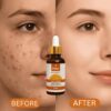 Anti-Aging & Hydrating Formula For Healthy Radiant Skin (30ml)