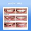 Snap On Smile - Veneers Teeth for Men and Women - Moldable False Artificial Braces Teeth - Image 4