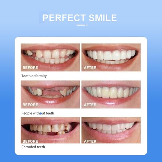 Snap On Smile - Veneers Teeth for Men and Women - Moldable False Artificial Braces Teeth - Image 4
