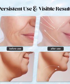 Massager for Face Lifting Facial Massagers EMS Neck Eye Massage Instrument Vibrator Microcurrents Red Light Therapy Anti Wrinkle - Random Color