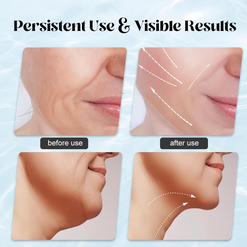Massager for Face Lifting Facial Massagers EMS Neck Eye Massage Instrument Vibrator Microcurrents Red Light Therapy Anti Wrinkle - Random Color