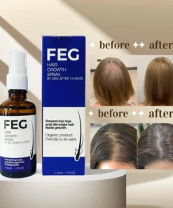 FEG PLUS Hair & Beard Regrowth Spray 50ml – Anti Hair Loss Formula with Minoxidil