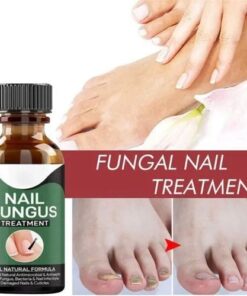 Fast Nail Fungus Treatment Serum – Nail Repair Essence for Finger & Toenail Care (All-Natural Formula)
