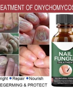 Fast Nail Fungal Treatments Nail Repair Essences Serum Care Treatments Foot Nail Fungus Removal Gel