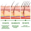 30ml Rosemary Hair Care Essential Oil Anti Hair Loss Growth Essential Oil Hair Care Nourishing Scalp Essential Oil - Image 3