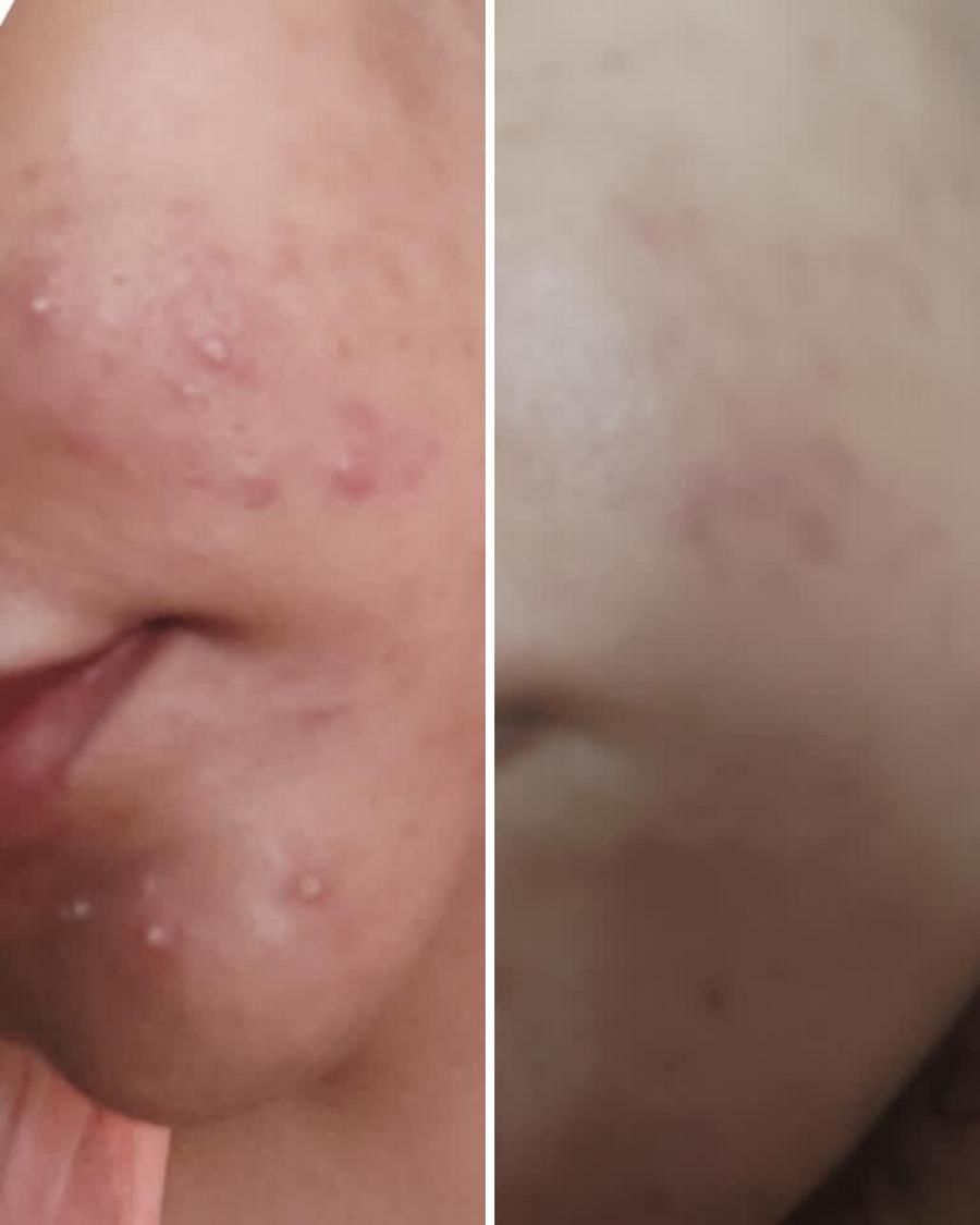 Nirvana Botanics- Vitamin C & E Serum 15ml - Image 2