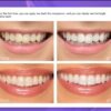 teeth brightening hismiles V34 Colour Corrector Serum 30ml - Image 4