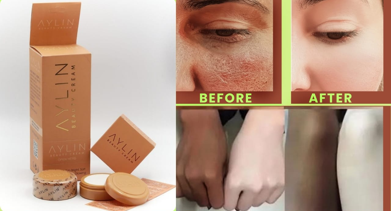 Aylin Beauty Cream Best Cream Ever | Best Quality Cream | Aylin Beauty Cream For Face Acne Pimples, & Blackheads | Whitening Cream ( Original ) - Image 5