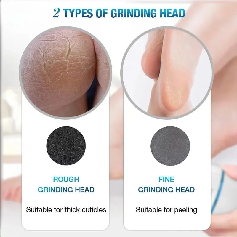 Rechargeable Pedicure Tool with Gentle & Powerful Exfoliation