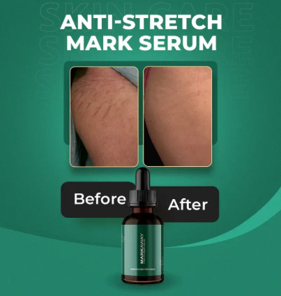& AHA/BHA-Free