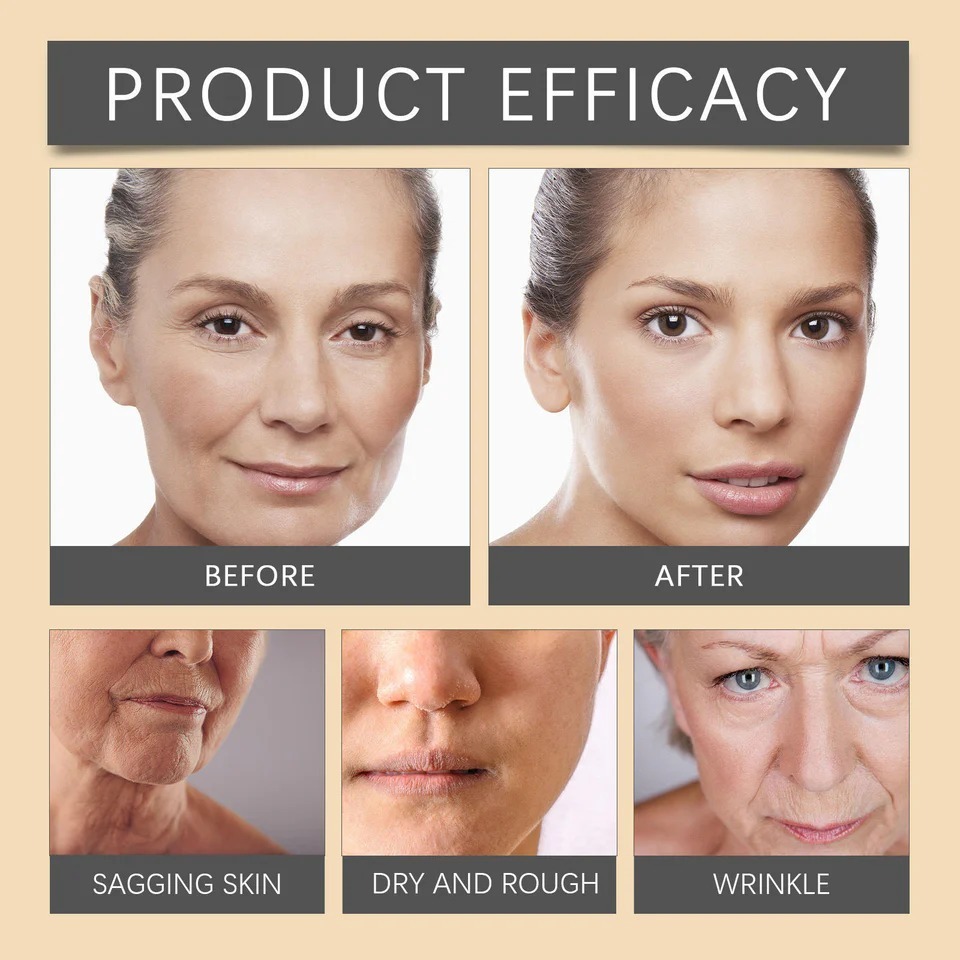 Botox Bee Venom Whitening & Moisturizing Cream – Anti-Aging, Brightening & Skin Firming Facial Care (50g) - Image 3