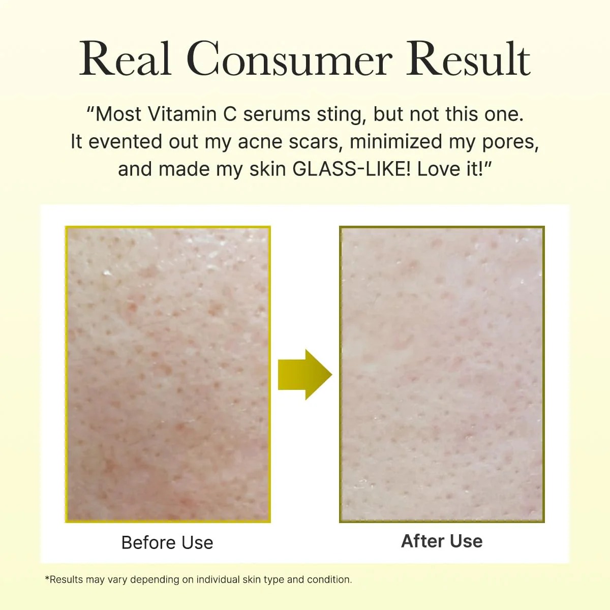 Arencia Vitamin C Booster Shot | Brightening & Skin Radiance Serum (30ml) - Image 3