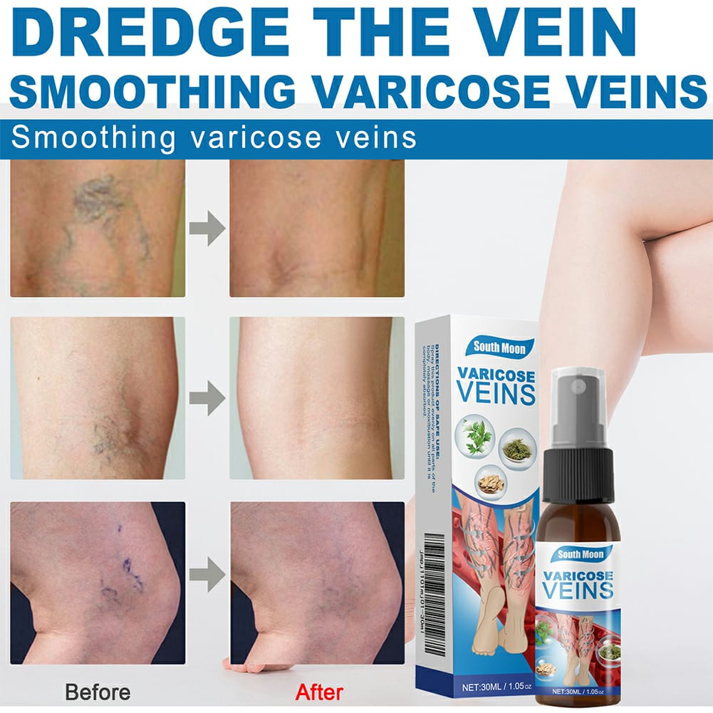 Leg Pain & Swelling Relief ~ 30ml