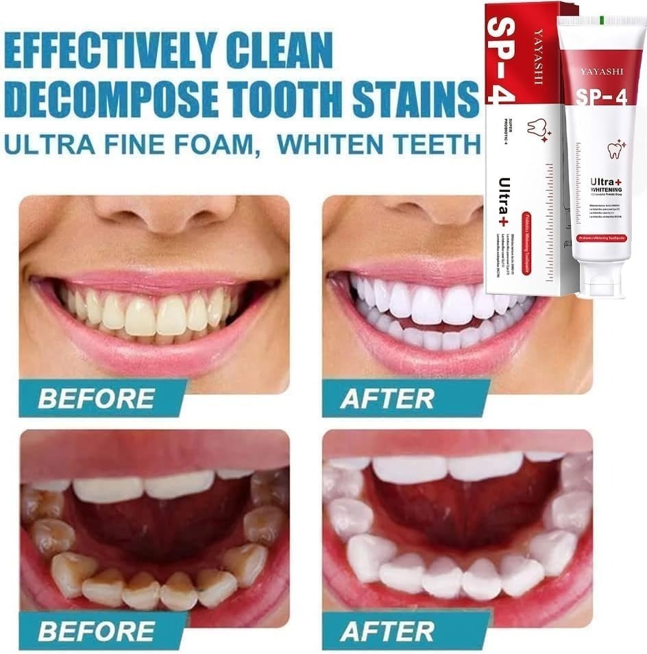 Yayashi SP-4 Ultra Whitening Toothpaste 150ml – Probiotic Stain Remover for Bright, Healthy Teeth - Image 3
