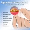 South Moon Lipoma Removal And Body Smoothing Cream 50g Herbal Natural Lump And Skin Knot Relief Ointment - Image 2