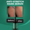 Markaway Stretch Mark Serum Herbal Formula for Scars & Skin Elasticity 30ml Nourishing, Repairing & Firming Skin Treatment - Image 3