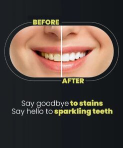 Teeth Whitening Strips 3D Gentle Stain Removing Enamel Safe Bright Smile Daily Treatment 14 Strips